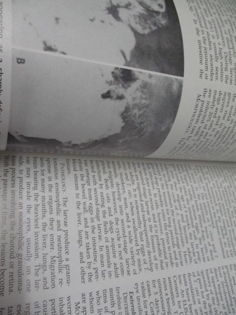 [USED] Hospital disposal book Gastroenterology 7 fourth English book