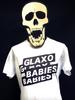 Glaxo Babies - This Is Your Life - T-Shirt