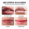 Marine Collagen Lip Mask with Strawberry Extract  Deep Hydrating, Wrinkle-Reducing, Plumping Lip Treatment  10 Pack for Smooth, Soft, Youthful Lips