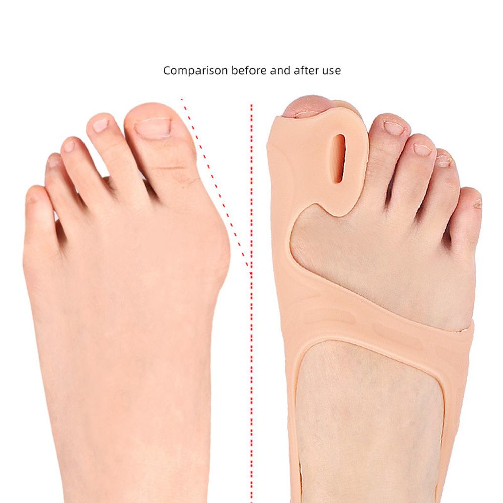 1Pc Ankle Brace Bunion Relief Corrector For Women & Men Gel Big Toe Straightener Fix Orthoses