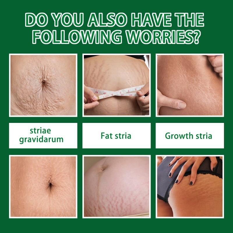 Jaysuing Skin Care Spray For Postpartum Skin Firming And Fine Line Reduction In 30ml Packaging