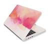 A+C Side Laptop Stickers Skins for Macbook /HP / Dell / Lenovo / Acer / ASUS Universal