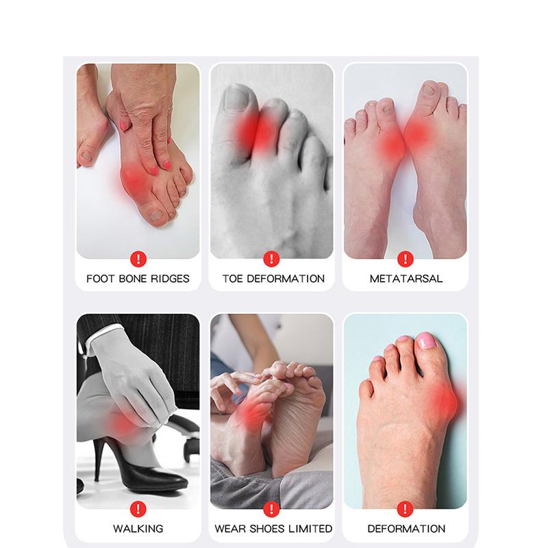 1Pcs Bunion Corrector Socks Comfortable Breathable For Day/Night Support Hallux Valgus Pain Relief Non-Slip Big Toe Straightener