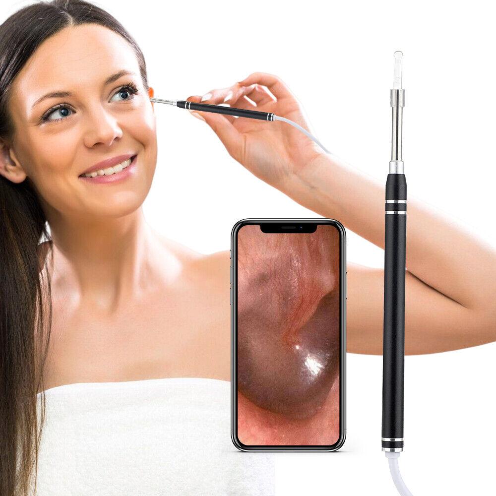 

Беспроводной удалитель ушной серы HD камера очиститель ушей набор эндоскопа для чистки ушей чёрный