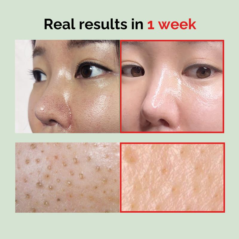 [mommy care] Sea Grape Cleansing Oil