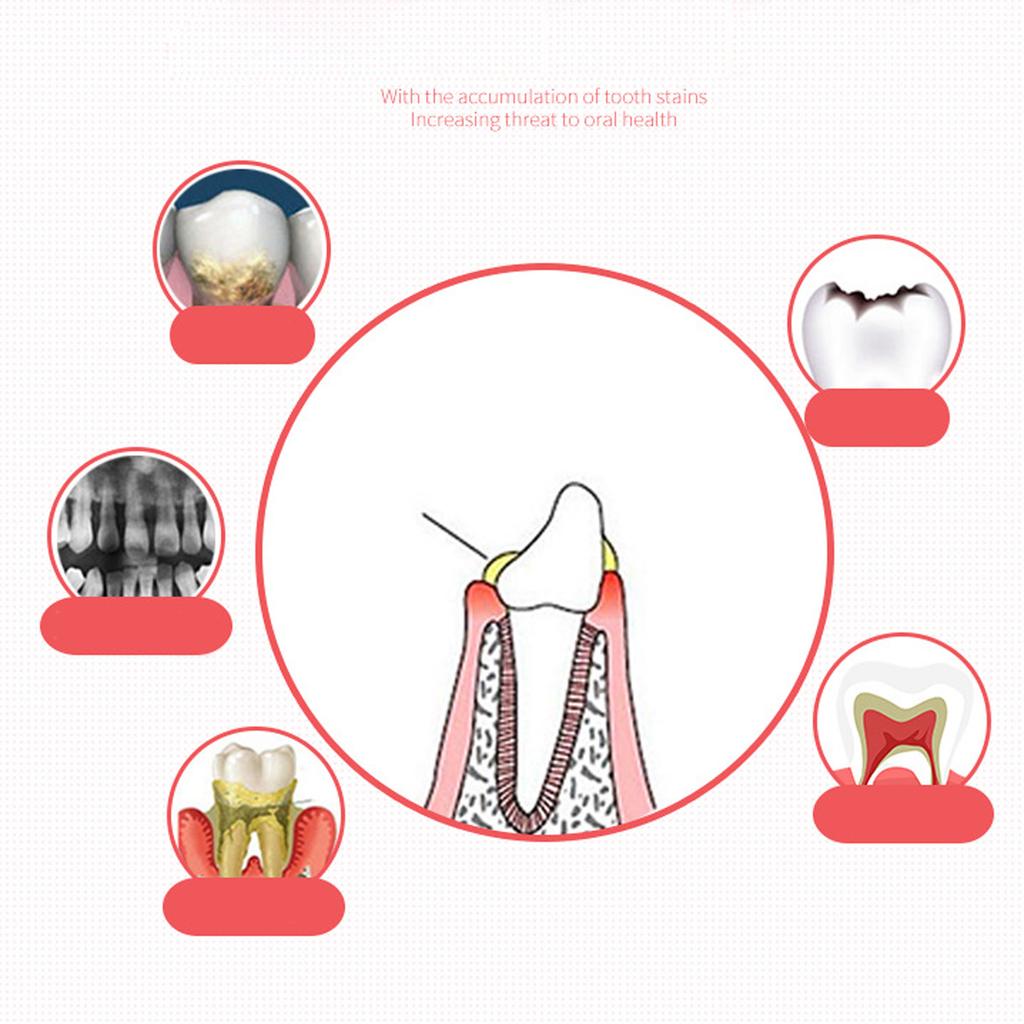 Plaque-Anfärbemittel Oraler Zahnstein-Test Untersuchung Dentalplaque-Indikator Flüssigkeit mit Messbecher 60ml