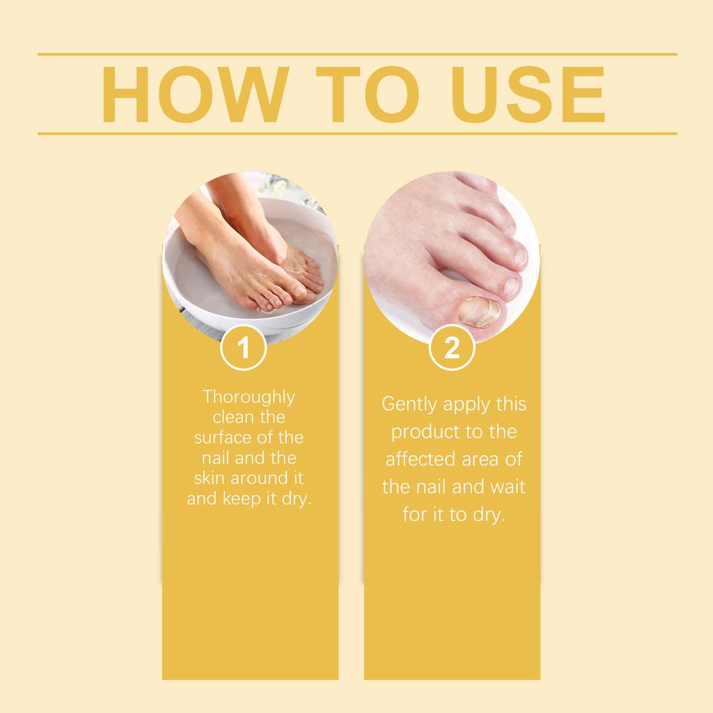 Bee Nail Liquid Special Liquid Nail Care Liquid Soft Nail Paste Nail Care Nail Care Onychomycosis Liquid8ml