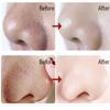 10/20/30 PCS Nose Remover Mask Deep Cleansing Skin Care Shrink Pore Acne Treatment Mask Nose Pore Cleasing Strips Black Head Remover Tool