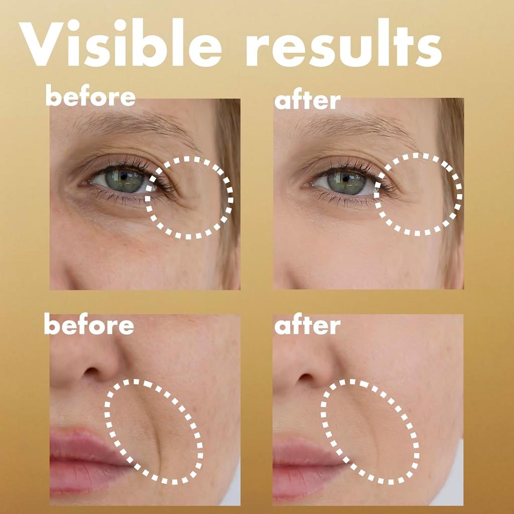 isoi Intensive Core Elastic Cream EX 35m – Rose Energy for Firm, Nourished, Wrinkle-Free Skin, Korean