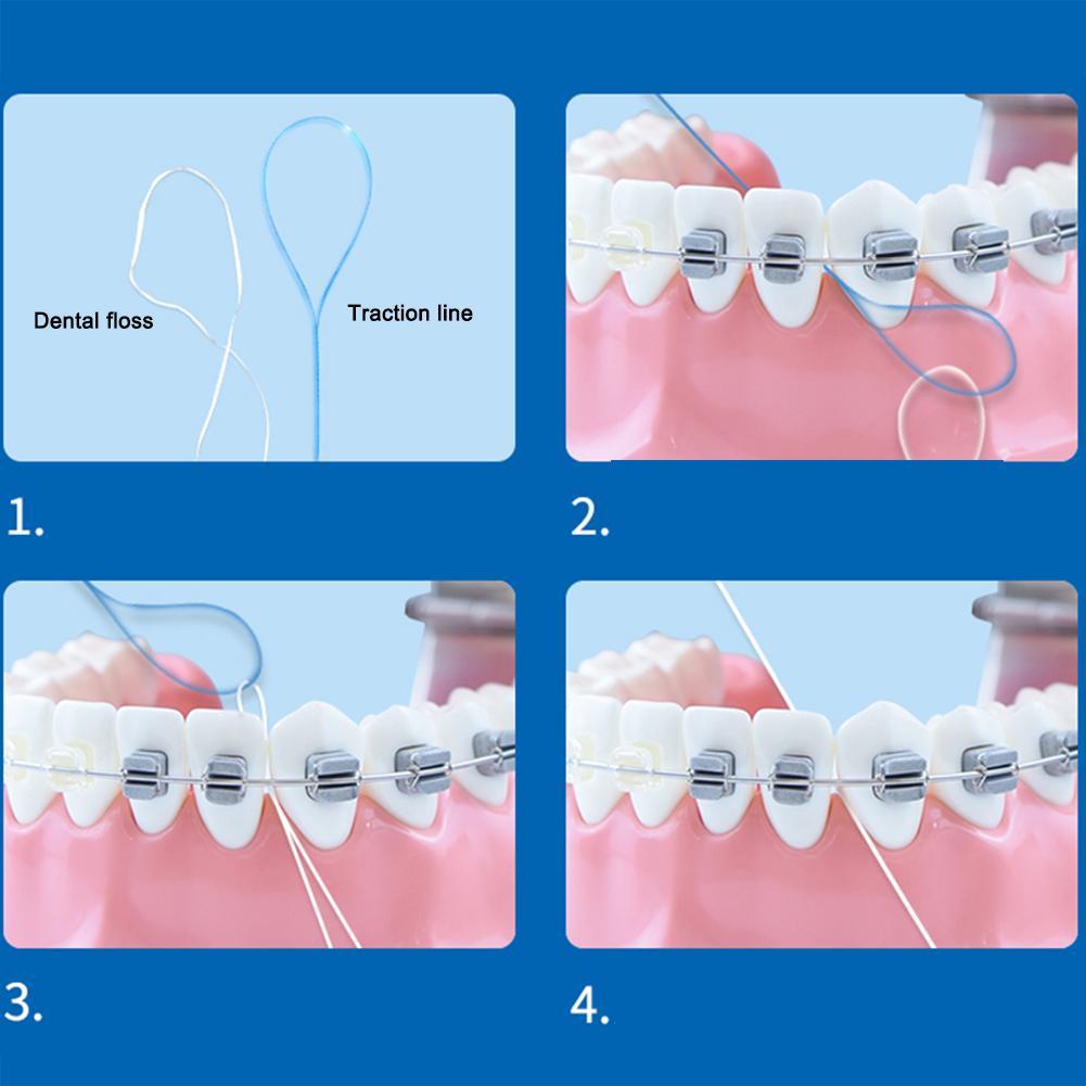 Dental Floss Needle Toy Threading Lead Wire Clamp Teeth Correction Threading Lead Wire Braces Steel Teeth Traction Wire