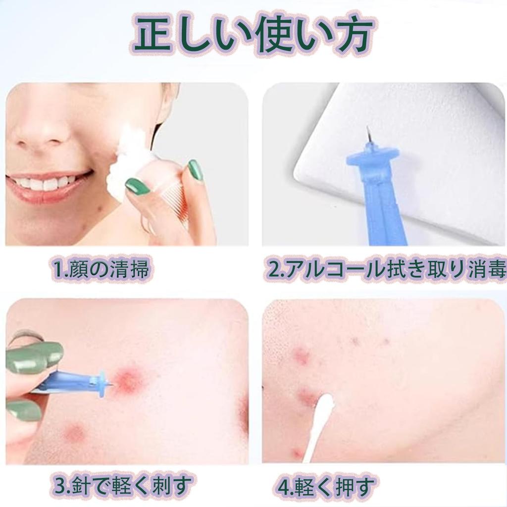 Roczential 100 Blackhead Removal Acne Pore ABS Easy To Disposable Beauty Tool Tools, Needles, Care, Material, Use, Portable, (Blue)