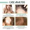 Revitalize Hair Growth Serum with Ginger & Plant Extracts  Nourishing Scalp Treatment for Thicker, Stronger Hair, Reduces Hair Loss & Promotes Natural