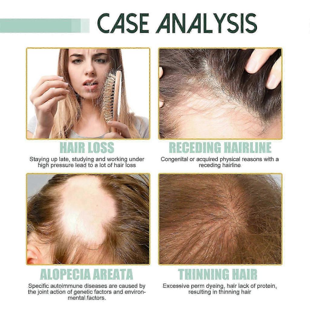 Revitalize Hair Growth Serum with Ginger & Plant Extracts Nourishing Scalp Treatment for Thicker, Stronger Hair, Reduces Hair Loss & Promotes Natural