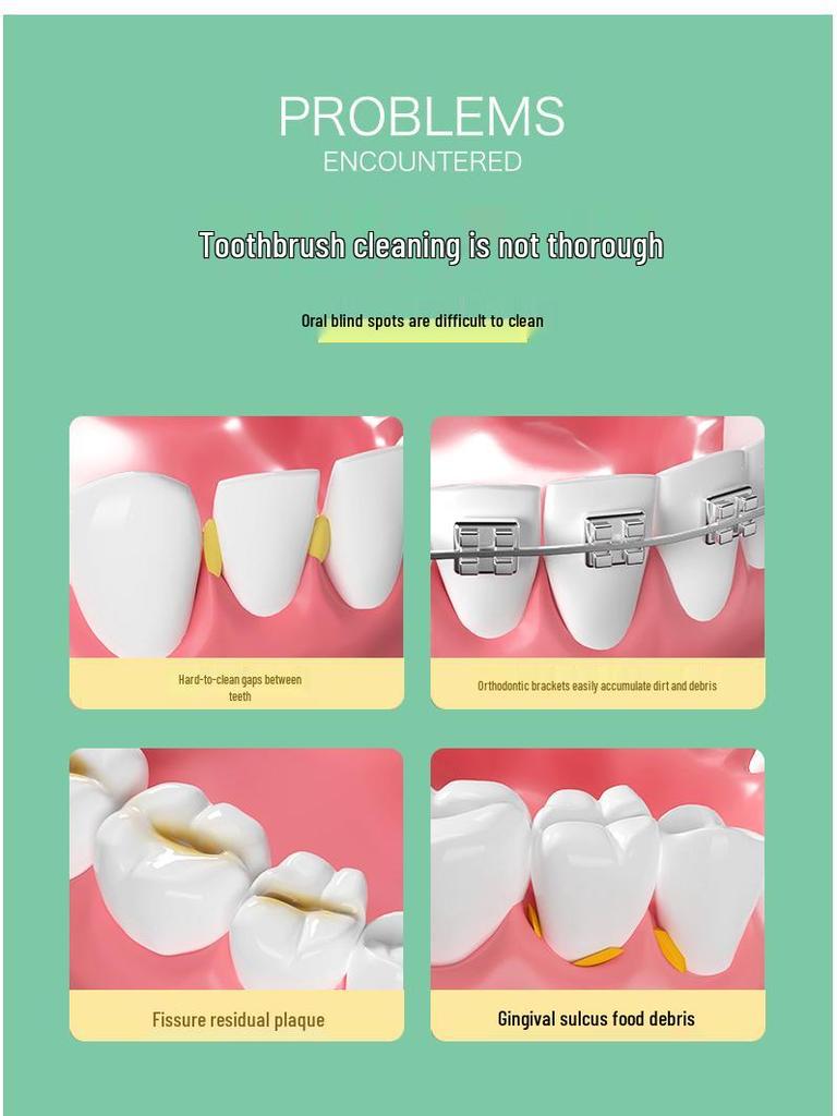 Yijie L-shaped Interdental Brush for Braces, 30pcs/box