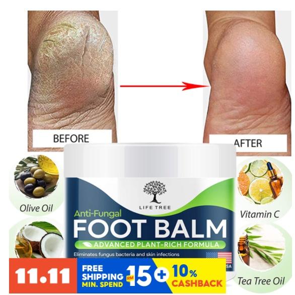

Foot Cure Полностью натуральный растительный бальзам для ног – увлажняющий крем для ухода за ногами для сухой кожи, потрескавшихся пяток и удаления мозоли - Сильный противогрибковый крем для ног