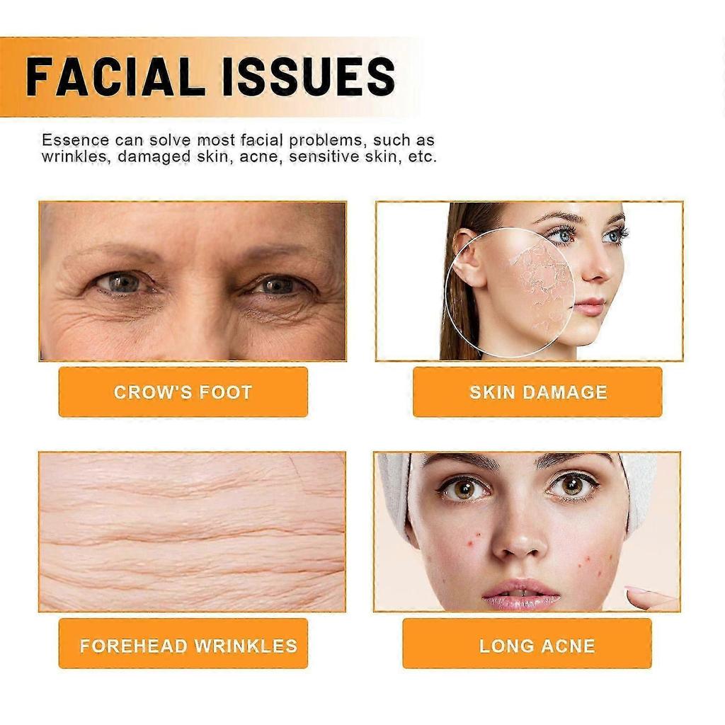 Vitamin C Face Serum - Reduces Fine Lines, Brightens Skin Tone, Hydrates & Moisturizes - 30ml