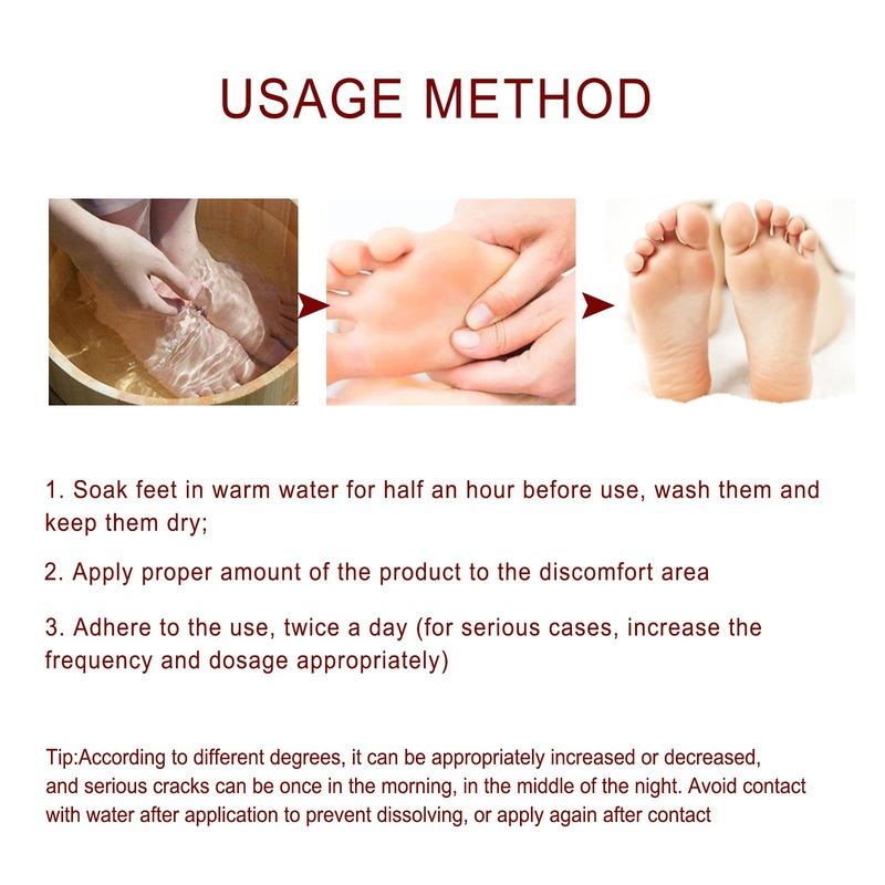 Equine Oil Foot Repair Cream Dry and Cracked Feet, Peeling, Nourishing, Moisturizing, Repairing and Anti Cracking Cream