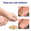 Szary plaster na paznokieć u stopy Plaster do naprawy paznokci grzybiczych Plaster korygujący wrastające paznokcie Pielęgnacja paznokci u stóp Plaster do leczenia zanokcicy 1/5 opakowań
