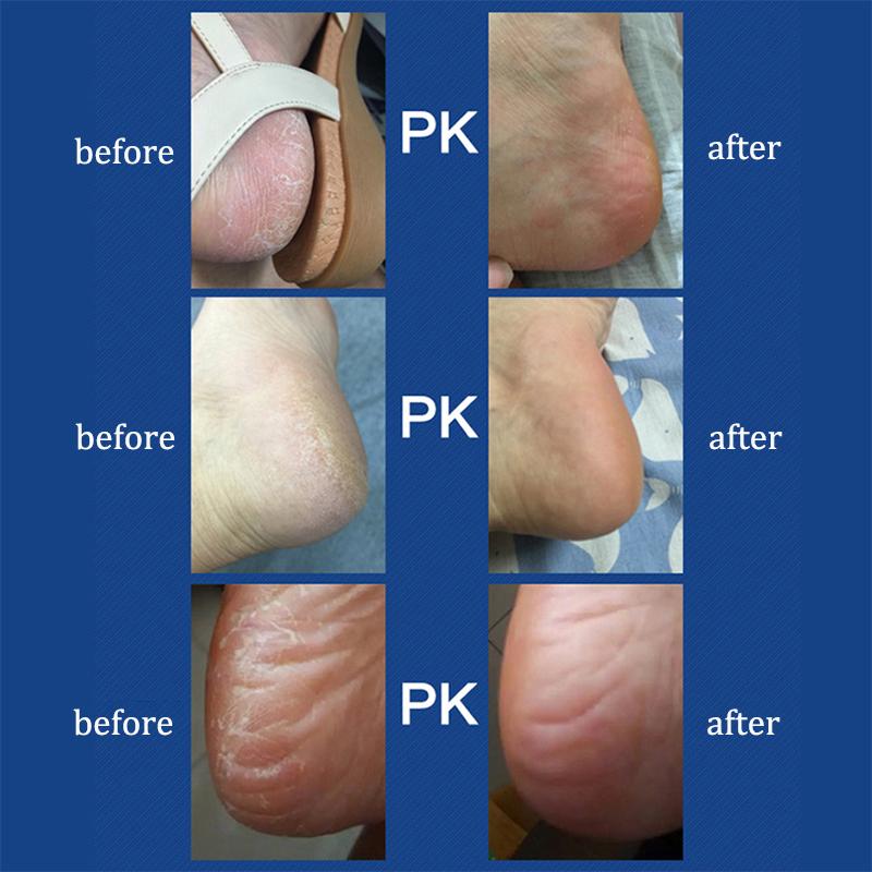 1Pc Electric Roller Foot File Grinder Foot Sandpaper File Heels Professional Foot Care Tool USB Rechargeable Heel Callus Remover