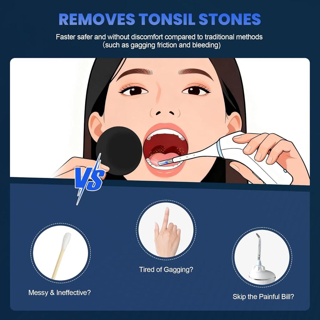 Electric Tonsil Stone Remover – Gentle Precise and Safe Removal with 3-Type Adjustable Suction & LED Light – Food-Grade Material,Rechargeable