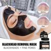 The latest 2025 blackhead removal mask, a peel-off activated charcoal cleansing mask, effectively removes blackheads.