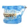 Dental Orthodontic Teeth Tooth Model 4 Kinds Brackets Ceramic and Metal Brackets for Patient Communication Dental Study Model