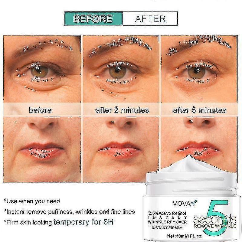 Retinol Wrinkle Removal Face Cream Firming Lift Anti-aging Eye Fade Fine Lines B
