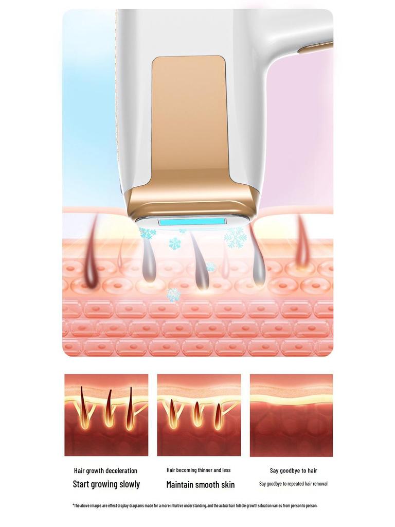 Precision IPL Hair Removal Device with Sapphire Ice-Cooled Photon Rejuvenation for Painless Full-Body Treatment