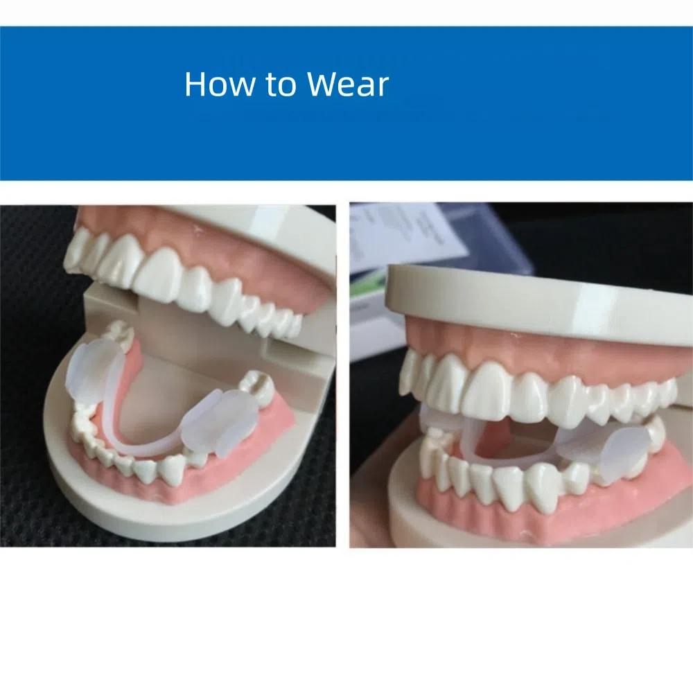 2Pcs Adjustable Anti-Snoring Mouthpiece Comfortable Snoring Mouth Guard  Bruxism