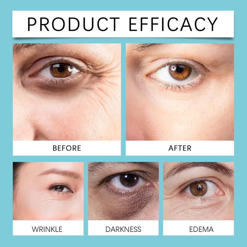 

Hoygi Eye Firming Cream Fade Fine Lines Lightening Dark Circles Anti-aging Hydrating Reduce Wrinkles Lifting Eyes Cream one size