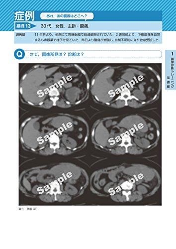 Imaging Diagnosis for Diseases and Pathology: Abdominal Emergency Diseases (Otsu Imaging Conference)