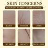 120ml Stretch Marks Oil