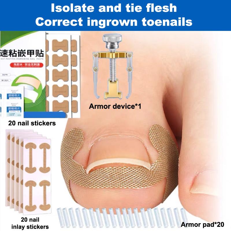 Ingrown Toenail Toe Correction Stickers Paronychia Treatment Recover Corrector Patches Feet Care Paronychia Treatment Recover
