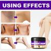 Armpit Whitening Cream Skin Lightening Bleaching Cream Underarm Dark Skin Legs Knees Whitening Intimate Body Lotion Moisturizing