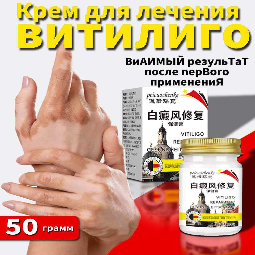 

Крем для облегчения витилиго, Крем для ухода за кожей, Крем от витилиго, Улучшает сухость, Подходит для всех типов кожи