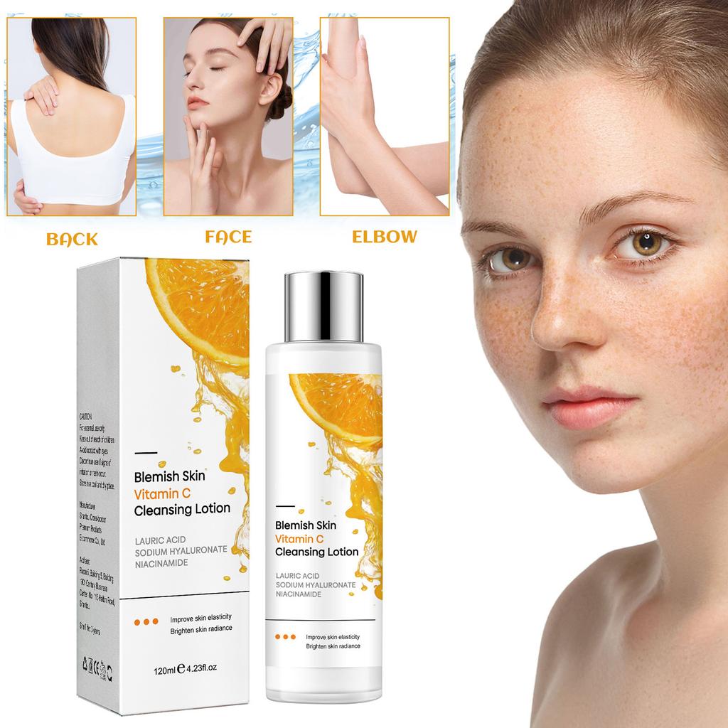 Hautaufhellung für die Achseln, Hautaufhellung für Gesicht und Körper, Aufhellung für Achseln, Hals, Knie, Ellbogen, 120 ml