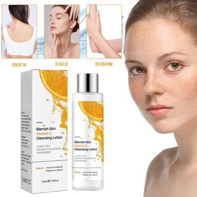 Skin Whitening Underarm , Skin Whitening For Face And Body, Whitening For Armpit, Neck, Knees, Elbows 120ml