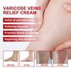 Varicose Veins Paste, 2024 New Varicose Veins Paste For Legs,Ointment Paste Against Spider Rice, Spider Rice Remove Paste.