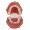 Modello Dimostrativo Ortodontico Dentale Modello di Denti con Fili Metallici e Bracket per Insegnamento
