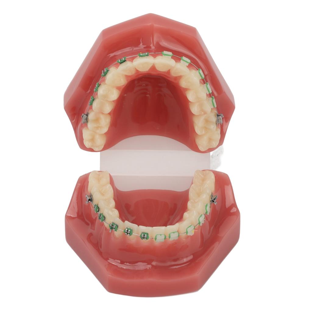 Modello Dimostrativo Ortodontico Dentale Modello di Denti con Fili Metallici e Bracket per Insegnamento