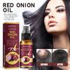 Red Onion Hair Growth Essential Oil Hair Care Spray Nourish Hair Roots Improve Hair Texture Hair Care Products