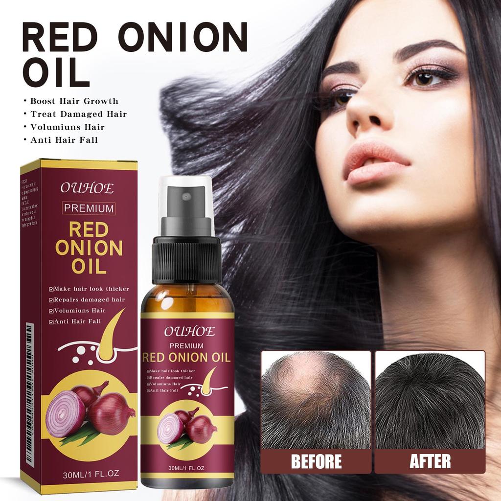 Red Onion Hair Growth Essential Oil Hair Care Spray Nourish Hair Roots Improve Hair Texture Hair Care Products