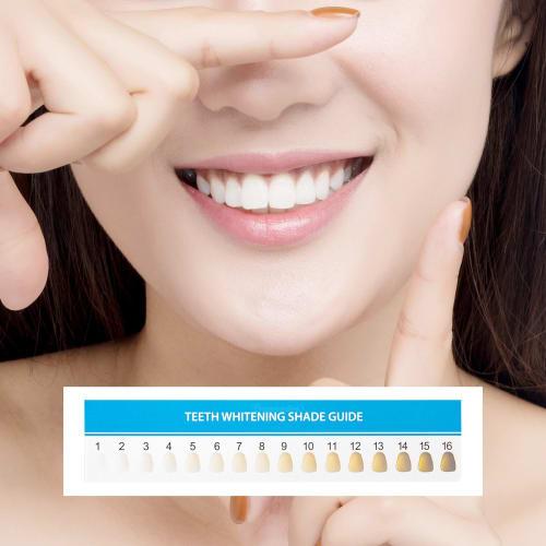 Framendino 20-Pack Teeth Whitening Shade Guide Papers, Teeth Bleaching Chart for Home Oral Care