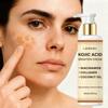 Kojic Acid Brighten Cream-Brightening And Moisturisin The Skin With Cocos Nucifera Oil-Suitable for All Skin Types, 100ml