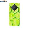 For Honor X9B Case Honor X9B Cover Luxury Clear TPU Cases Shockproof Silicone Protective Shell Phone Back Cover For Honor X9B