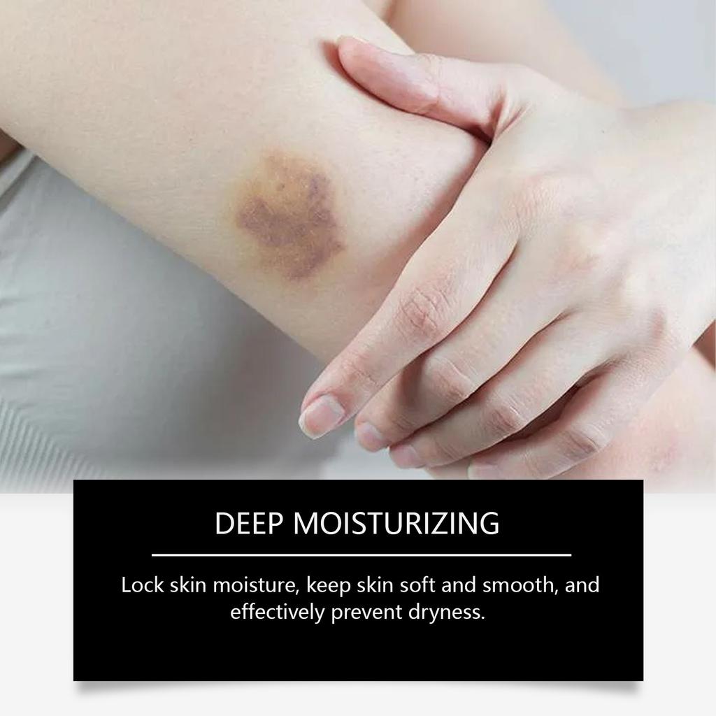 Herbal Soothing Cream Stimulates Collagen Production To Reduce All Types Of And Improve Skin Texture