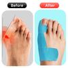 10Pc Bunion Corrector Tape Toe Separator Hallux Valgus Orthosis For Big Toe Pai Relief Correction Sports Protective Straightener