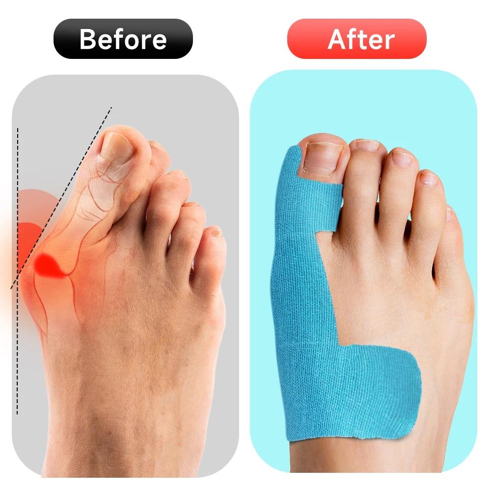 10Pc Bunion Corrector Tape Toe Separator Hallux Valgus Orthosis For Big Toe Pai Relief Correction Sports Protective Straightener