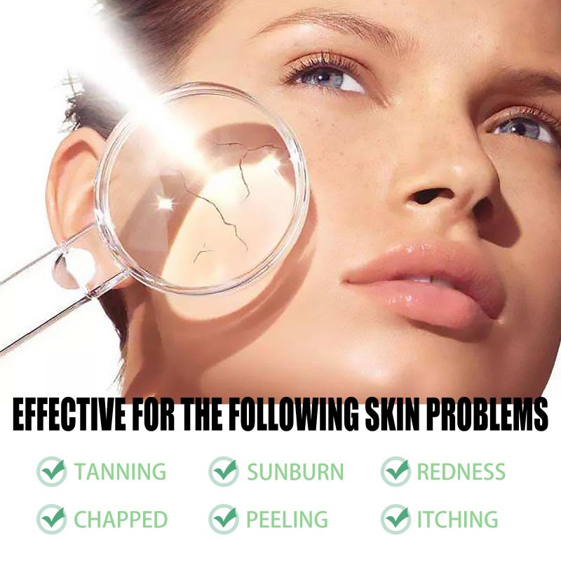 Aloe Vera Sunburn Care Gel After Sun Repair Cream for Face and Body Deep Hydration Moisturizing Sensitive Skin