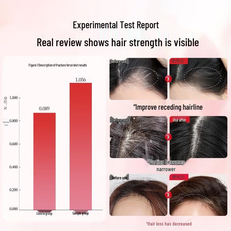 Bawang Women's Anti-Hair Loss Oil Control Volumizing Shampoo